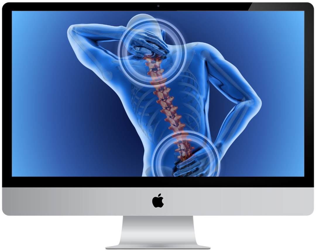 Neuromuscular Pain Syndromes