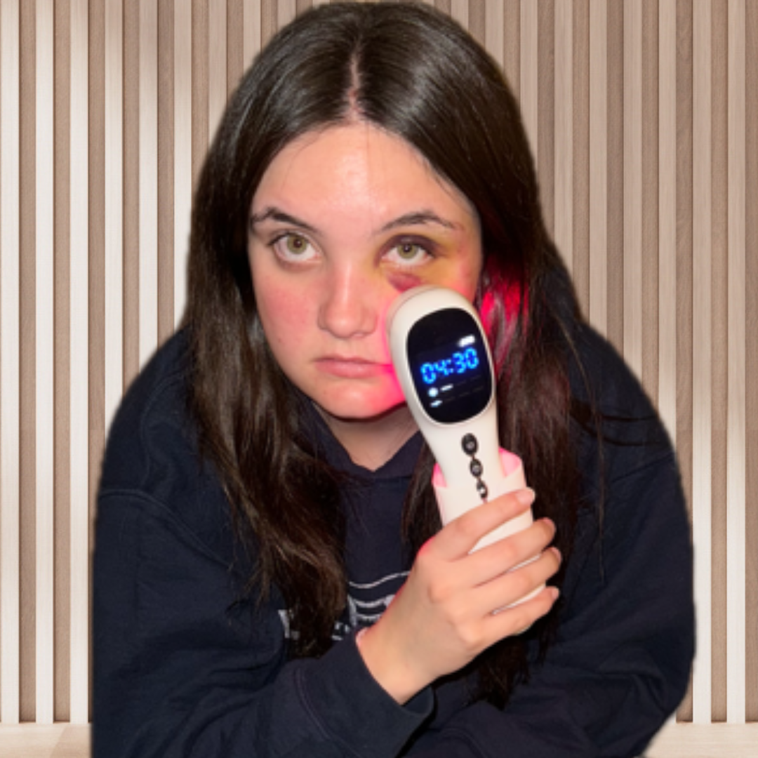 true laser face injury progression images final day 4 of laser therapy treatment